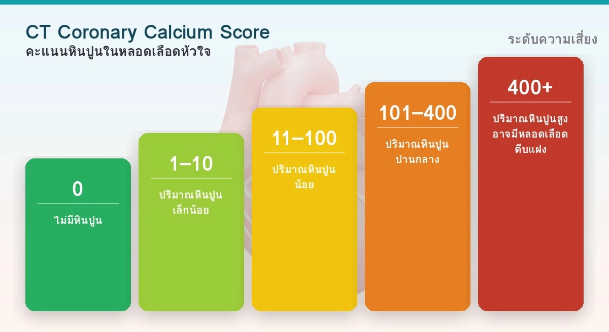 Infographic เปรียบเทียบระดับคะแนน Calcium Score 0 ถึง 400 ขึ้นไป และความเสี่ยงหลอดเลือดหัวใจตีบ